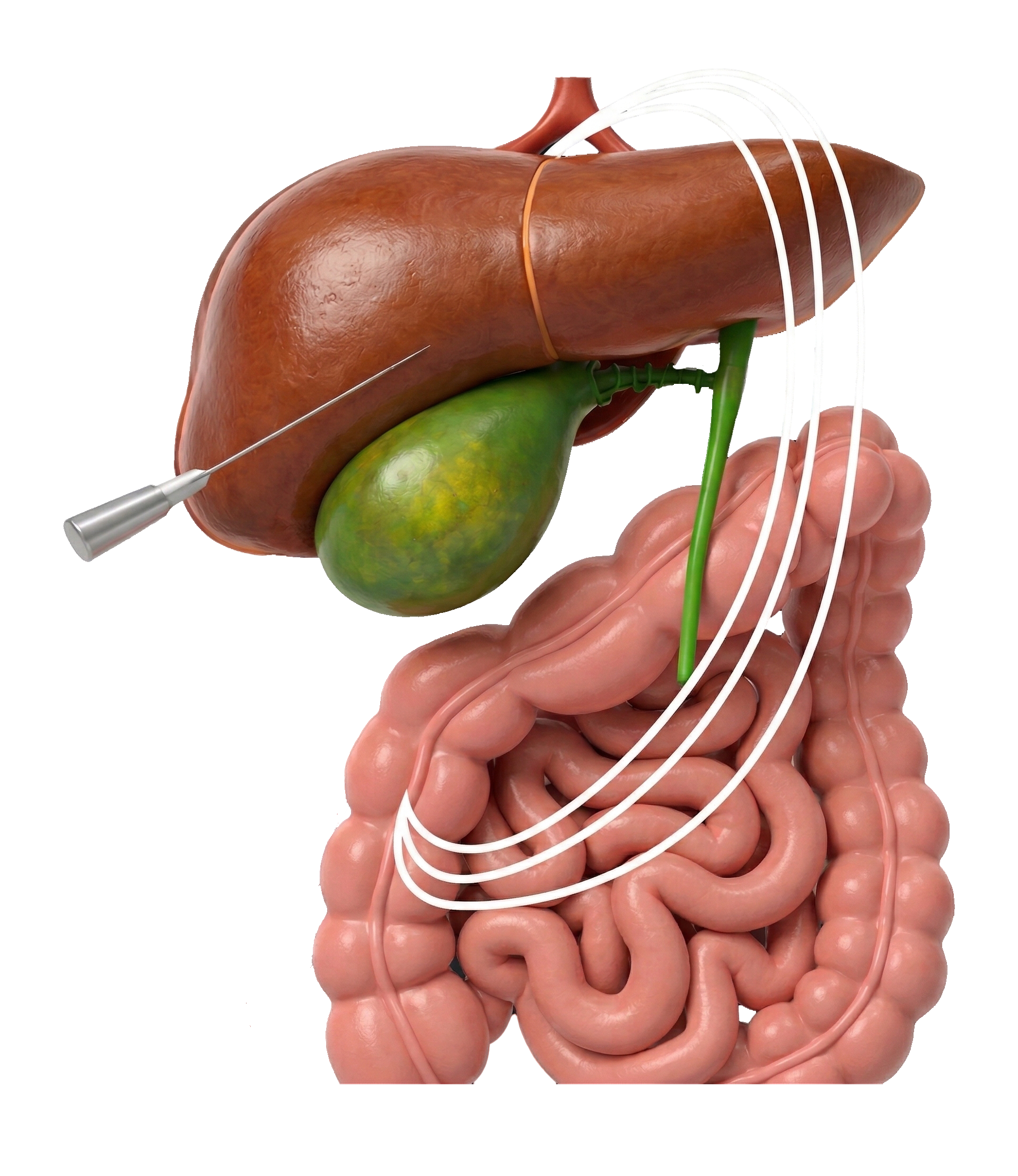 ICONO PERCUTANÉA OKO